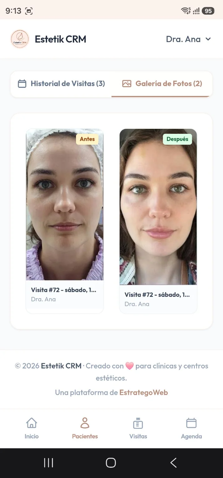 Galería de fotos antes y después